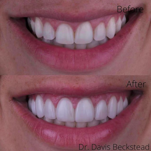 Images Beckstead Dental Group