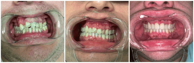 Images Summer Creek Dental