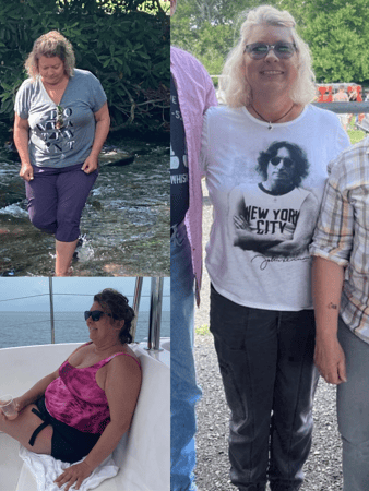Images Lake Norman Skin and Laser