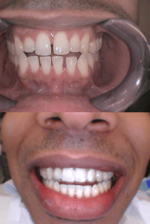 Images SoftTouch Dentistry of Newton