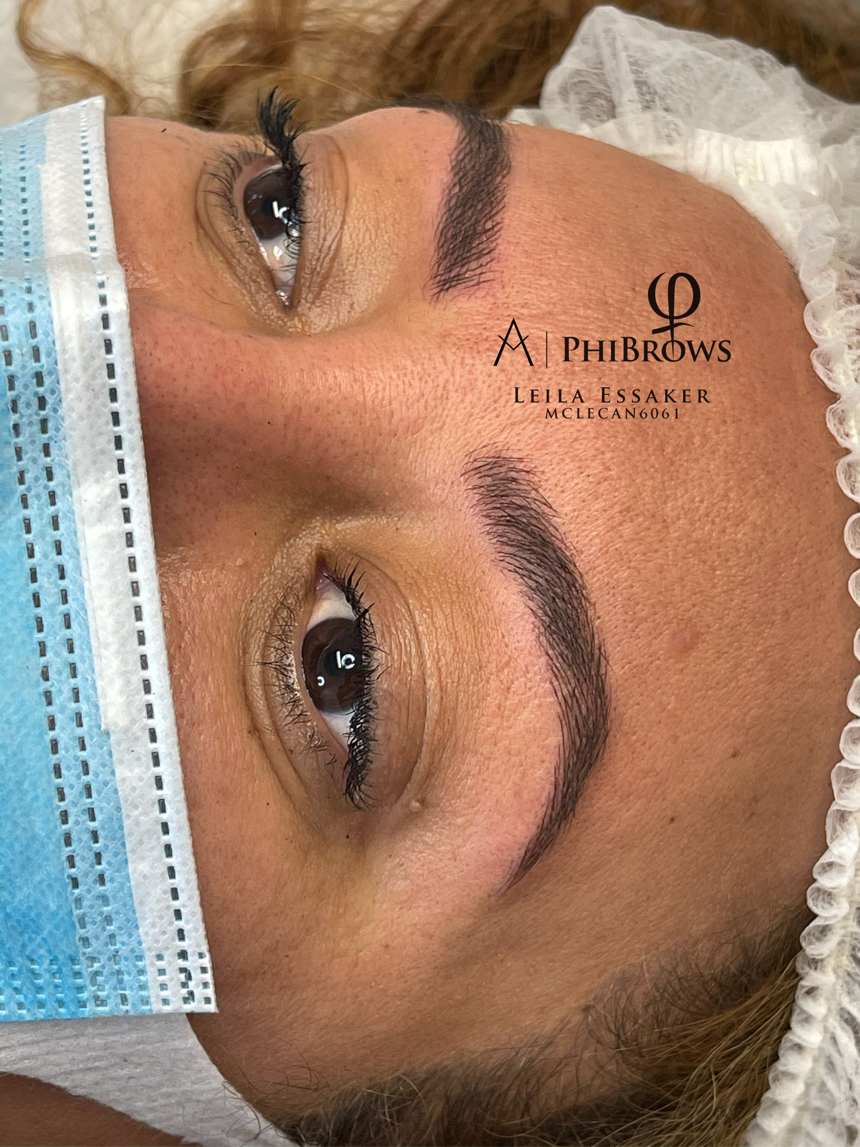 Images Clinique d'Esthétique Leila - Hydrafacial, Microblading, Épilation Laser Sainte-Foy