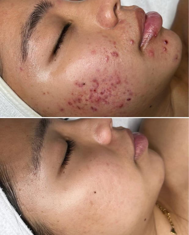 Images Face of Jules