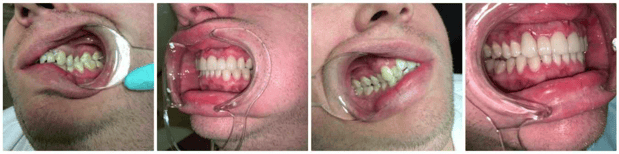 Images Summer Creek Dental