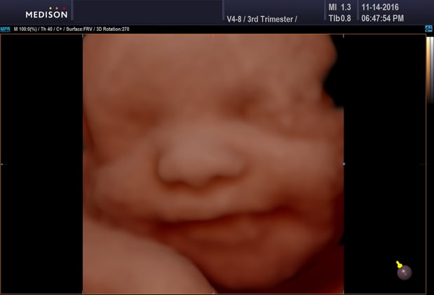 Images Heavenly 3D 4D Ultrasounds