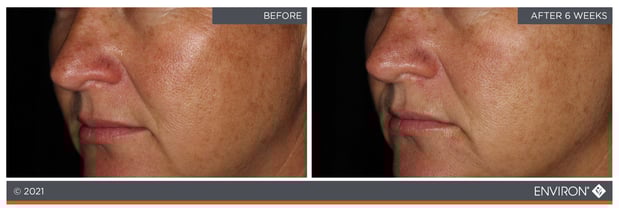 Images Celtic Spa & Laser Services