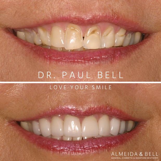 Images Almeida & Bell Dental Lone Tree - General, Cosmetic, and Implant Dentistry