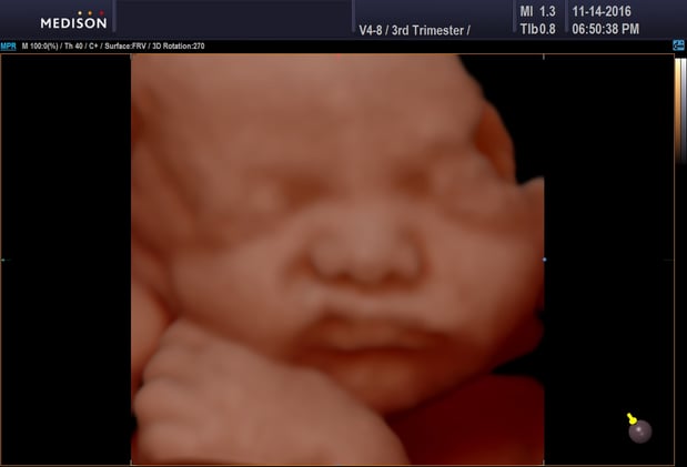 Images Heavenly 3D 4D Ultrasounds