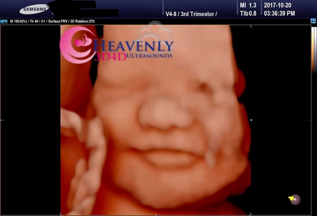 Images Heavenly 3D 4D Ultrasounds