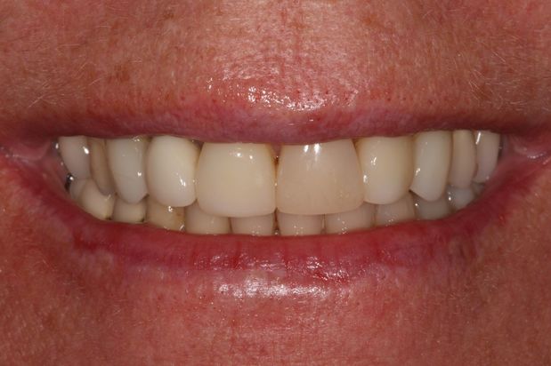 Images Aaron A. Leishman DMD, PA