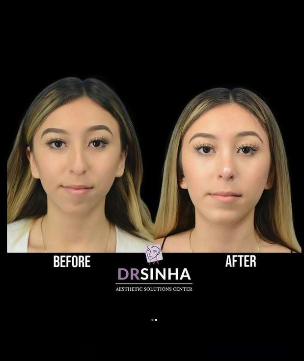 Images Pradeep K Sinha MD PhD FACS - Facial Aesthetic Surgery