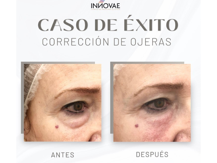 Images Clínica Innovae Medicina Estética