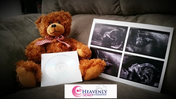 Images Heavenly 3D 4D Ultrasounds