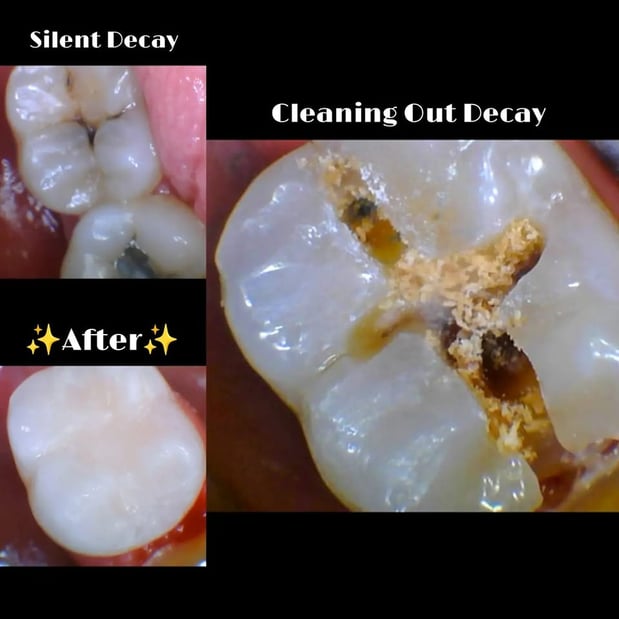 Images Northeast Lincoln Family Dentistry