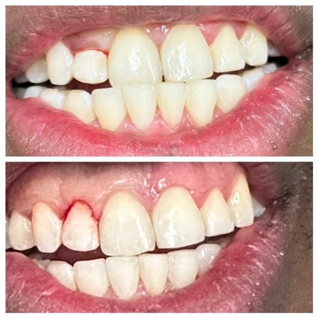 Images Best Dental - Family & Orthodontics