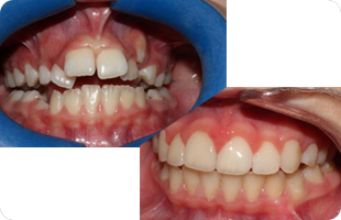 Images Clínica Dental Infantil y Adultos Dra. Begoña Gutiérrez Abascal