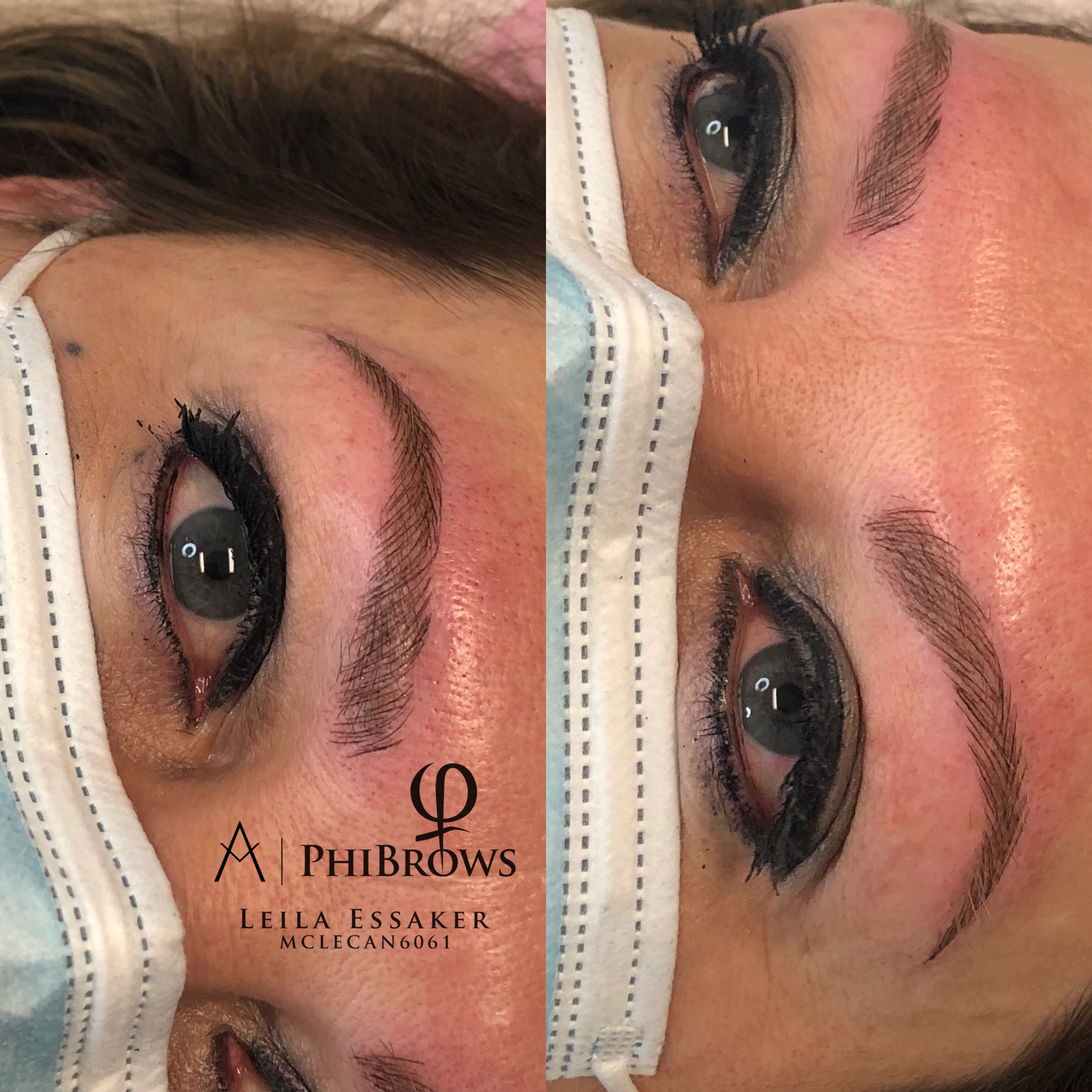 Images Clinique d'Esthétique Leila - Hydrafacial, Microblading, Épilation Laser Sainte-Foy