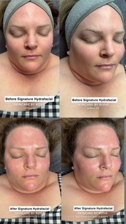 Images Skincare by Rosie