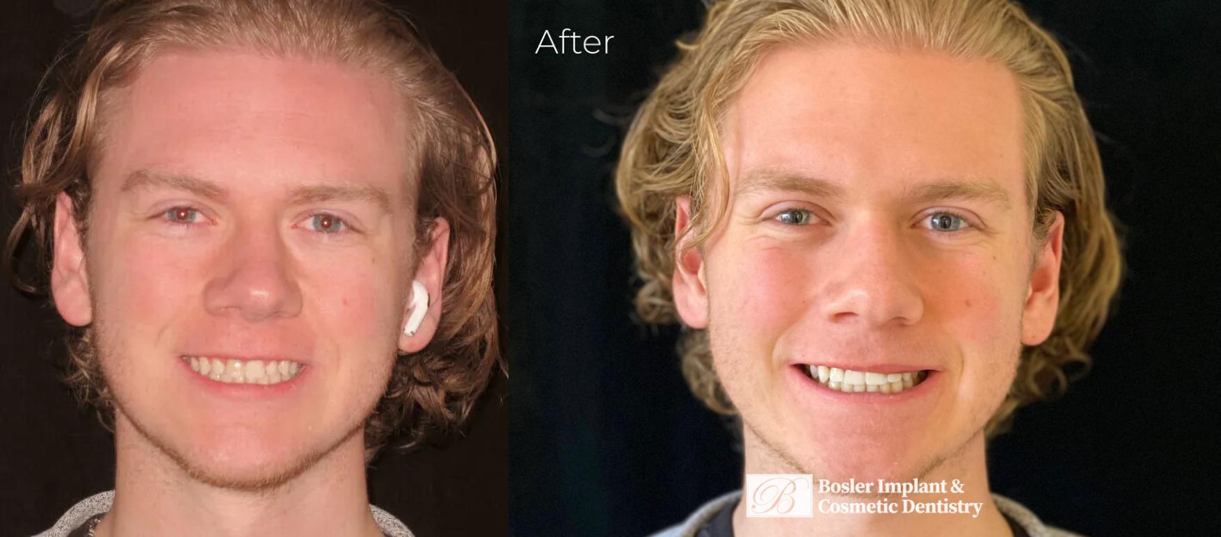 Bosler Implant & Cosmetic Dentistry Image