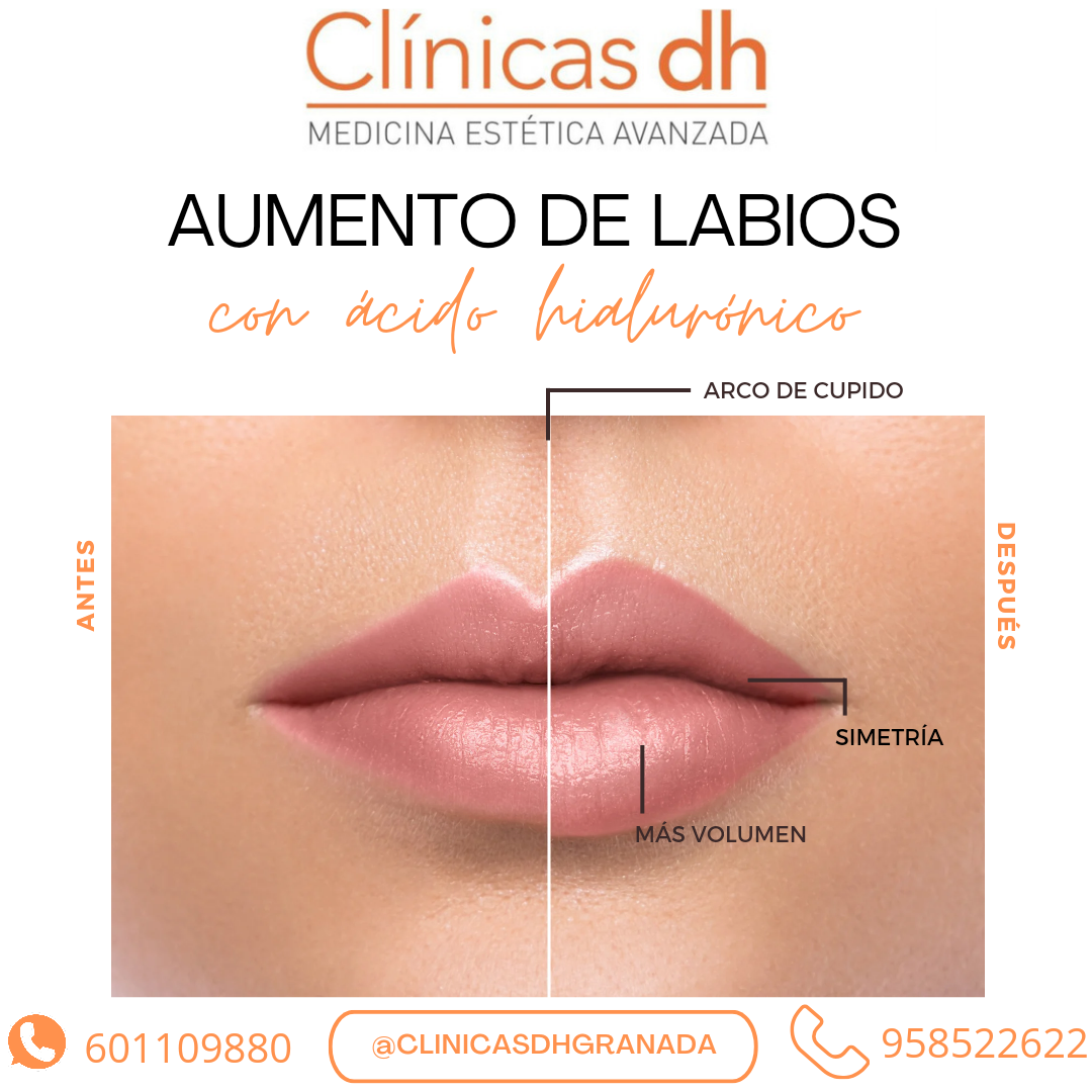 Images Clinicas Dh