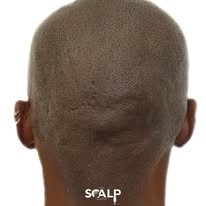 Images The Scalp Master
