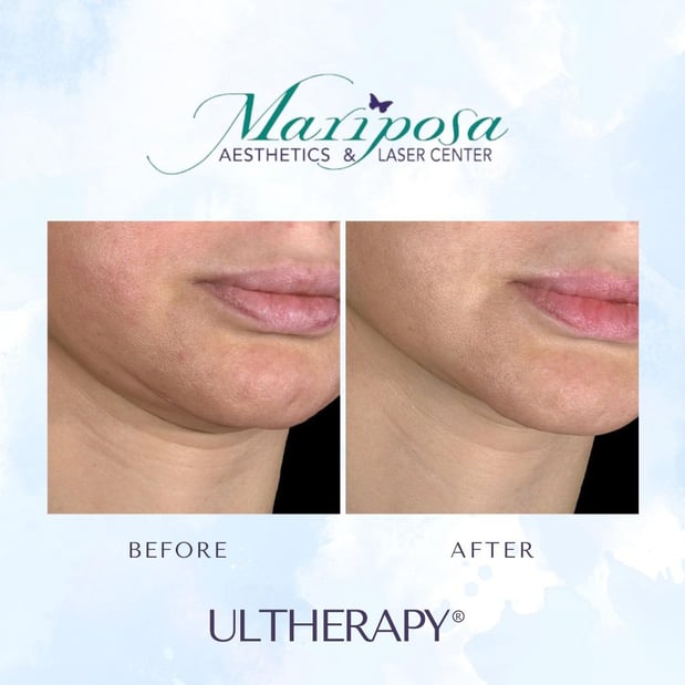 Images Mariposa Aesthetics & Laser Center