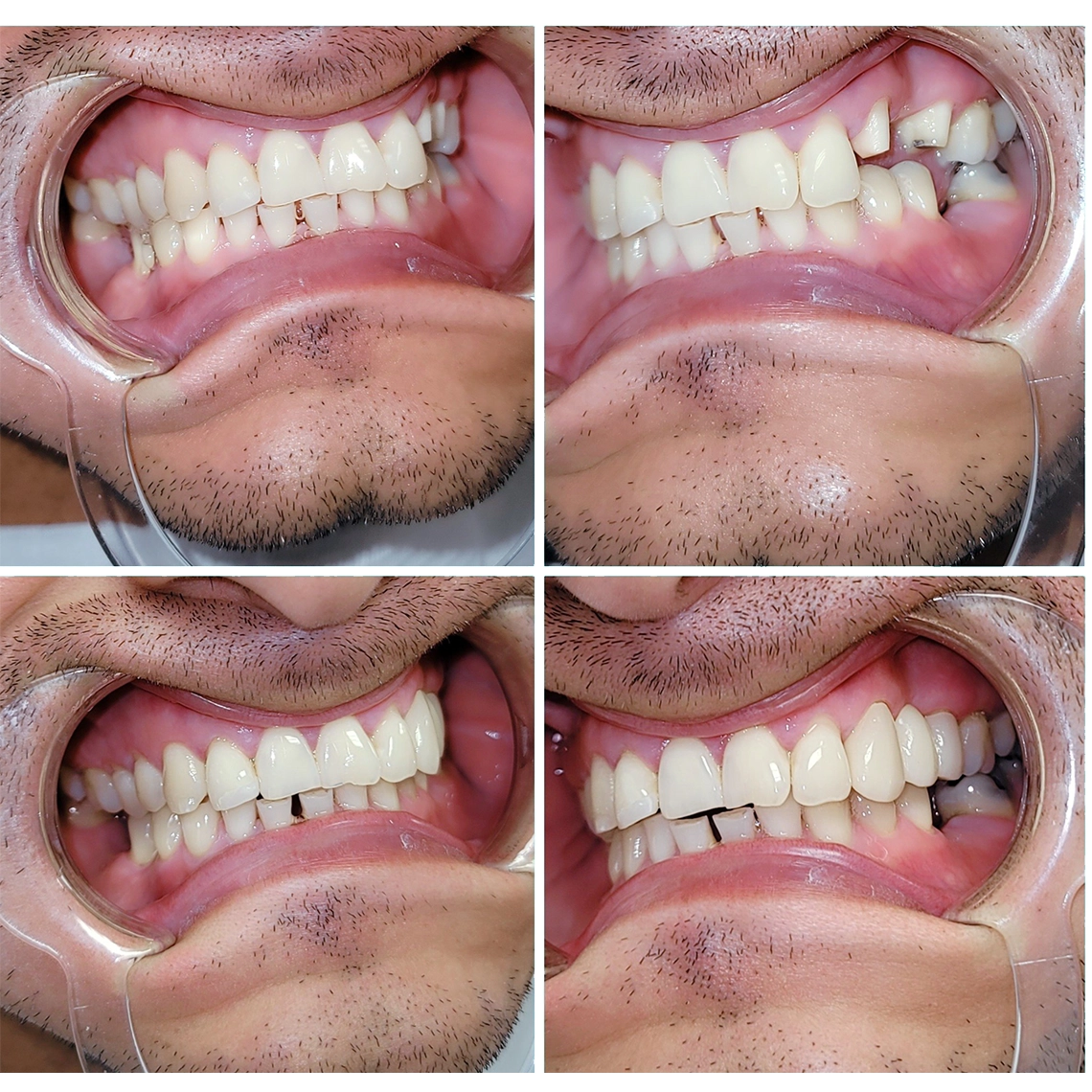 Marcos Torres Dental Esthetics-Servicio de Ortodoncia