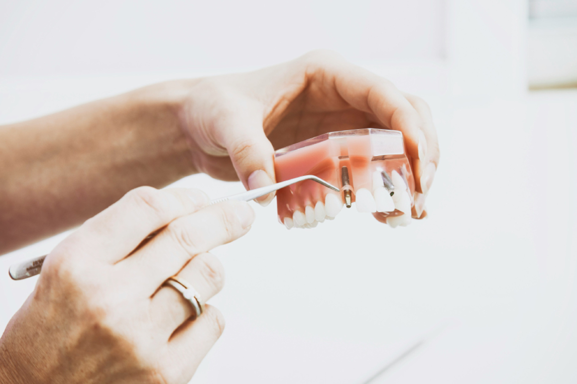Images Sann Dental AB