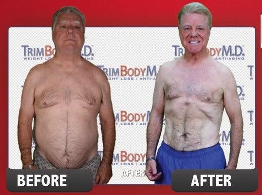 Images TrimBody M.D.