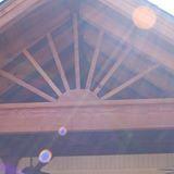 DPM Remodeling
