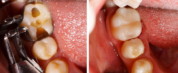 Images Champlain Smiles