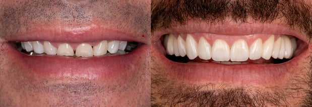 Images Hoopes Dental