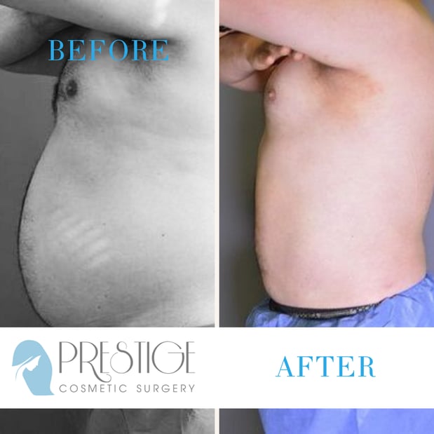 Images Prestige Cosmetic Surgery