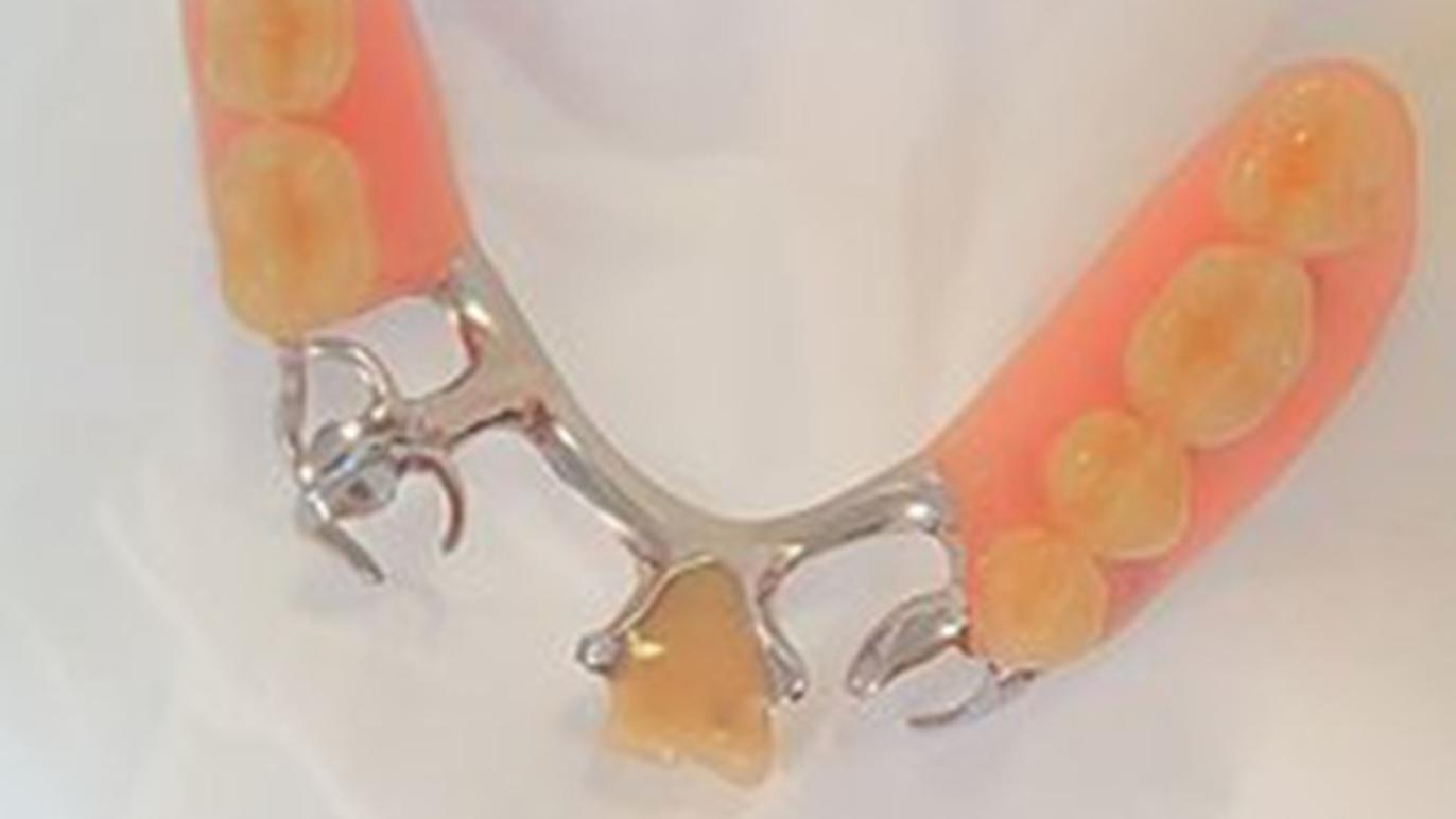 Images Kliniske Tandteknikere Linda Holst & Christian Boljanac