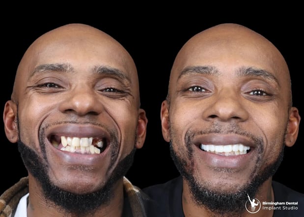 Images Birmingham Dental Implant Studio
