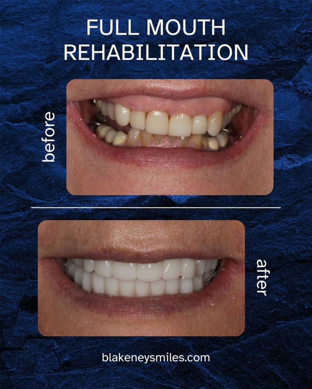 Images Advanced Dentistry of Blakeney