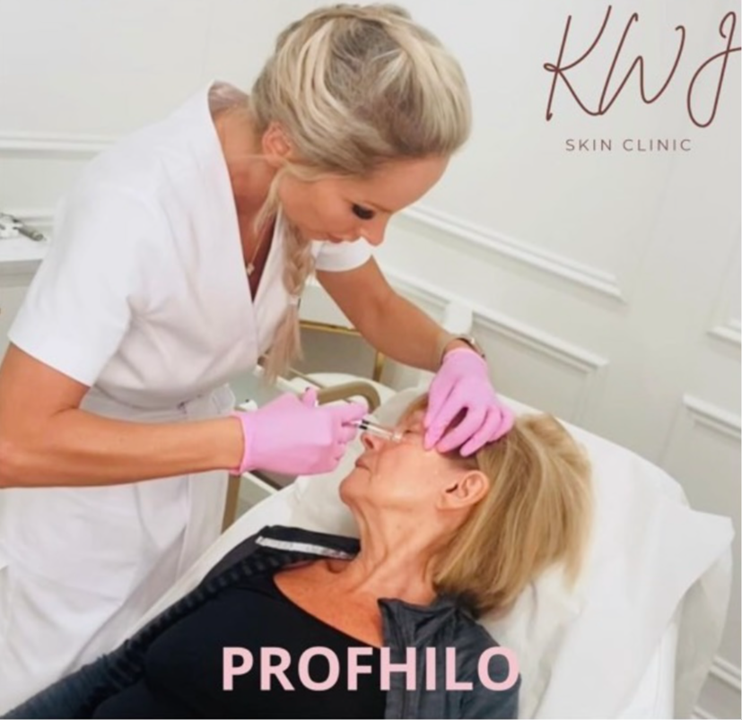 Skin booster injectable treatment in action at KWJ Skin Clinic, a skin and aesthetic clinic in Broadbridge Heath, Horsham, offering Profhilo, Seventy Hyal, Polynucleotides and skin hydration treatments.
