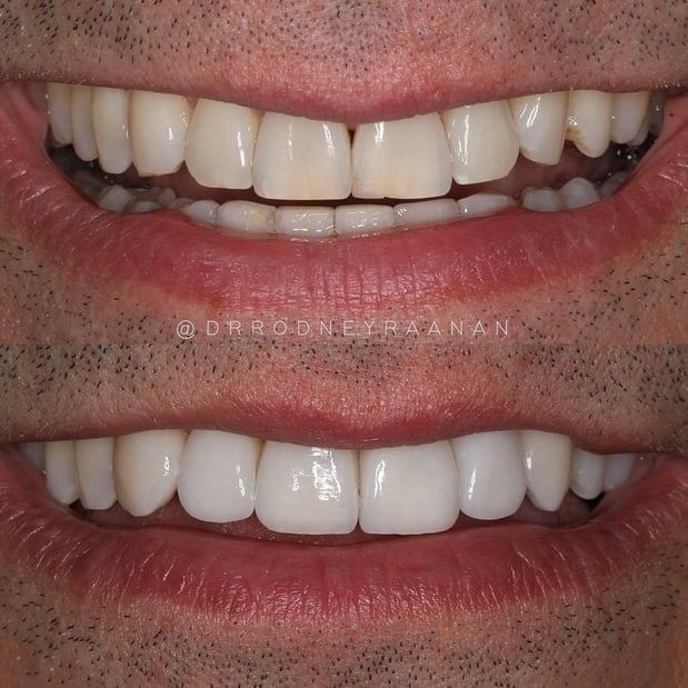 Images Dr. Rodney Raanan