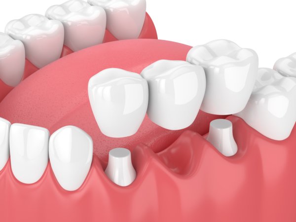 Images Clinique Dentaire Dr. Karam - Dentiste, Blanchiment Dentaire Ahuntsic