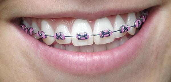 Images Salaita Orthodontics