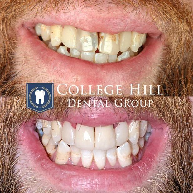 Images College Hill Dental Group