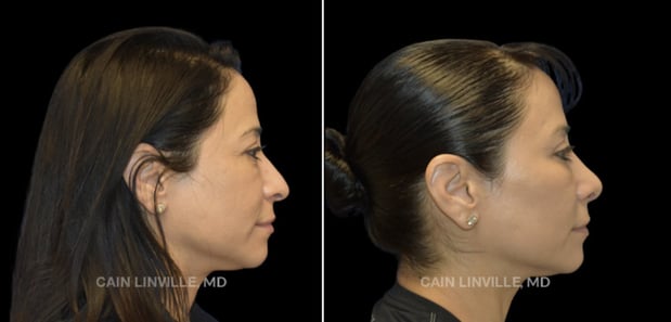 Images Linville Plastic Surgery
