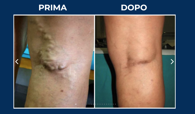 Images Dott. Massimo Gallucci | Specialista in Angiologia