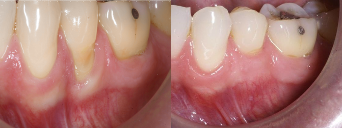 Images Advanced Periodontics and Dental Implants, LLC