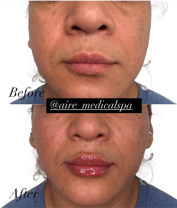 Images Aire Medical Spa