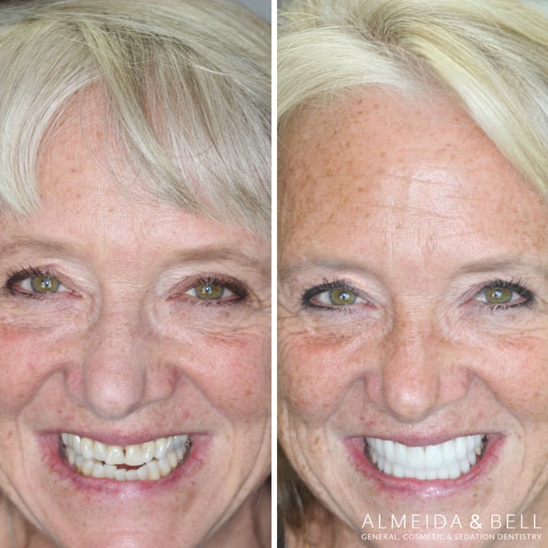 Images Almeida & Bell Dental Lone Tree - General, Cosmetic, and Implant Dentistry
