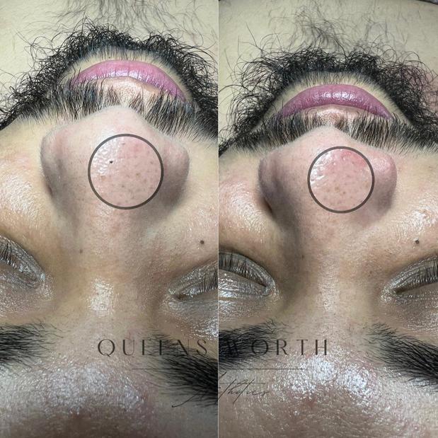 Images Queens Worth Aesthetics