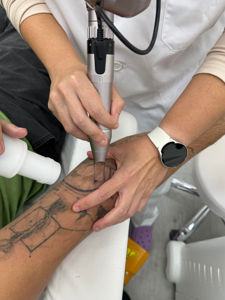 Images Dra. Silvia Solà. Medicina Estética y Láser