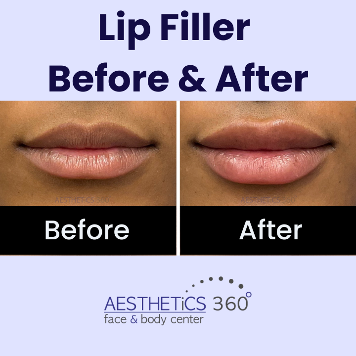Images AESTHETICS 360° Face & Body Center