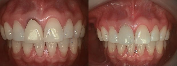 Images Complete Dental Health