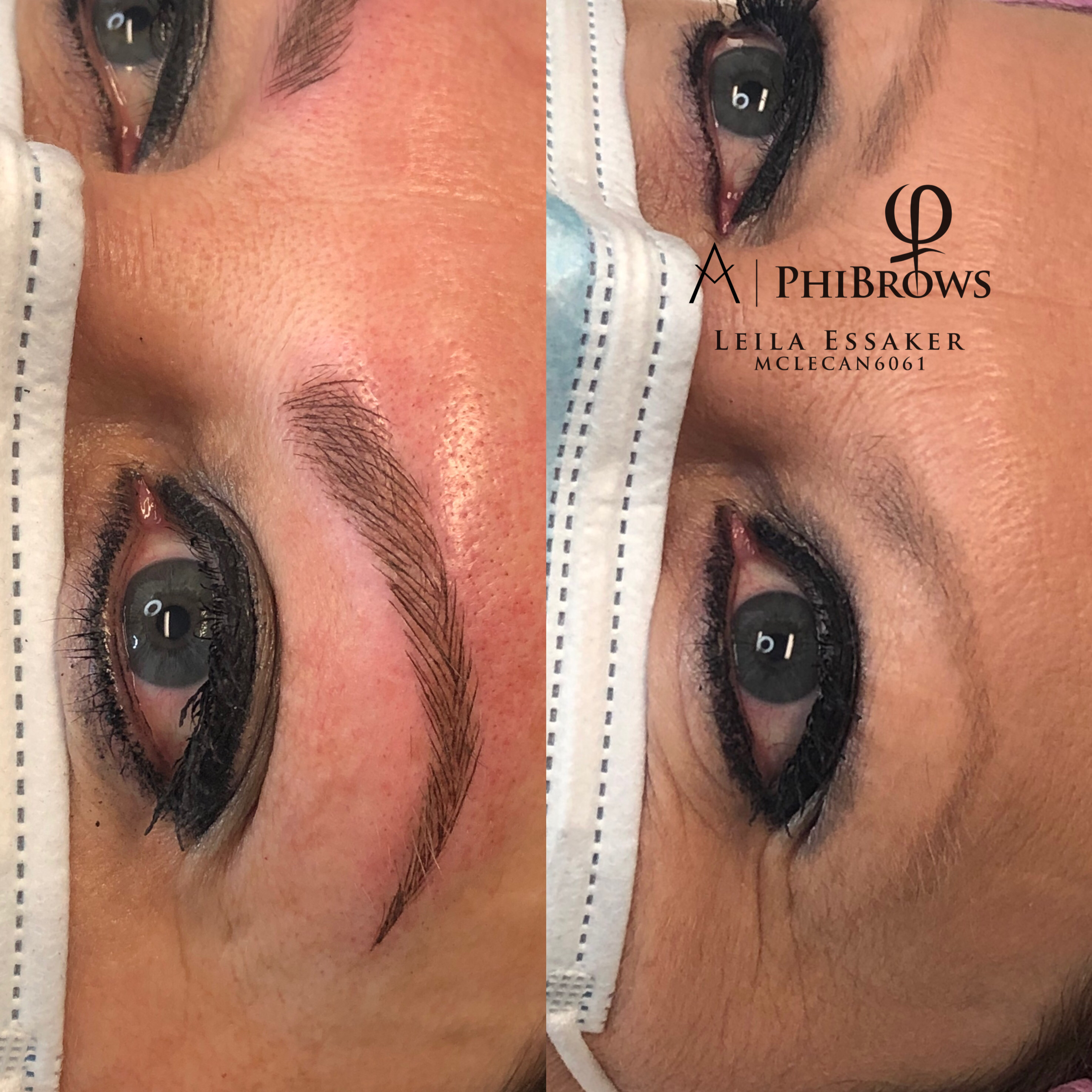 Images Clinique d'Esthétique Leila - Hydrafacial, Microblading, Épilation Laser Sainte-Foy